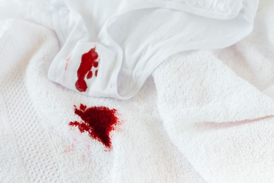 Oxiclean vs Zep Stain Remover: Which Works Better for You?